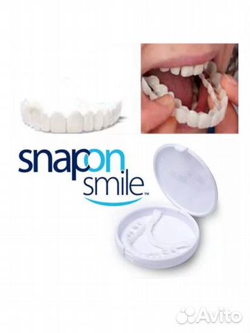 Виниры Snap-On Smile Виниры Snap-On Smile