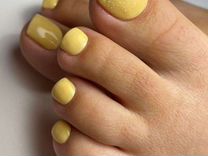 Uñas de los pies amarillas